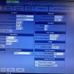 GE Ultrasound Logiq V5-YOM 2016 GE Logiq V5-YOM Ultrasound