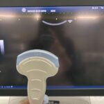 GE Ultrasound Logiq E9-YOM 2016 GE Logiq E9-YOM Ultrasound