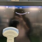 GE Ultrasound Logiq E9-YOM 2016 GE Logiq E9-YOM Ultrasound