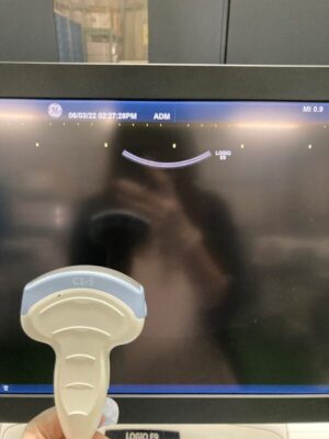 GE Ultrasound Logiq E9-YOM 2016 GE Logiq E9-YOM Ultrasound