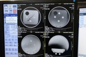 GE Optima 660 CT Scan