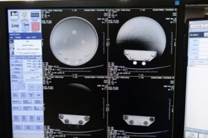 GE Optima 660 CT Scan