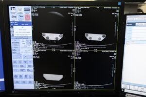 GE Optima 660 CT Scan