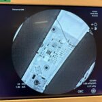 GE OEC 9900 Elite XR