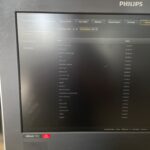 Philips Ultrasound AFFINITI 70C-SN US118F0066 Ultrasound