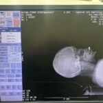 GE Optima 660 CT Scan