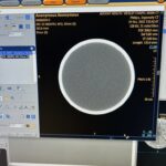 Philips CT Ingenuity Core CT Scan