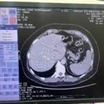 GE Optima 660 CT Scan