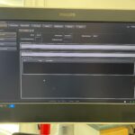 Philips Ultrasound EPIQ 7G-SN US316B1120 Ultrasound