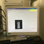 Hologic Bone Densitometer Discovery-YOM 2010 Hologic Discovery-YOM 2010 Bone Densitometer