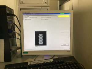Hologic Bone Densitometer Discovery-YOM 2010 Hologic Discovery-YOM 2010 Bone Densitometer