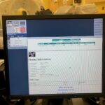 GE CT LightSpeed VCT 64-Slice GE CT LightSpeed VCT 64-Slice CT Scan