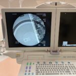 GE OEC 9900 Elite XR