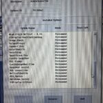 GE CT Revolution Evo GE CT Revolution Evo CT Scan