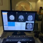 Philips MRI Achieva 1.5T, SN 22153, YOM 2008 Philips Achieva 1.5T, SN 22153, YOM MRI