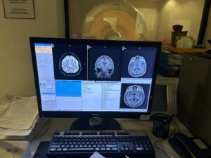 Philips MRI Achieva 1.5T, SN 22153, YOM 2008 Philips Achieva 1.5T, SN 22153, YOM MRI