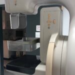 Philips MammoDiagnost DR 2 WO Stereo Philips MammoDiagnost DR 2 WO Stereo Mammography