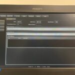 Philips Ultrasound Affiniti 70-SN USN17F1152-YOM 2017-(Probes: L12-3, L12-5, C5-1, S5-1, C10-3v) Philips Affiniti 70-SN USN1…