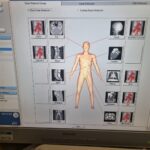 Philips CT Brilliance 64-Slice-YOM 2010-Upgraded to 64 2016-T YOM 2016 Philips CT Brilliance 64-Slice-YOM 2010-Upgraded to 6…