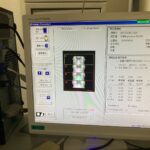 Hologic Bone Densitometer Discovery-YOM 2010 Hologic Discovery-YOM 2010 Bone Densitometer