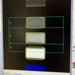 GE Bone Densitometer Lunar Prodigy-YOM 2010 GE Lunar Prodigy-YOM 2010 Bone Densitometer