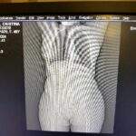 Siemens CT SOMATOM EMOTION 16-YOM 2011-T YOM 2011 Siemens CT SOMATOM EMOTION 16-YOM -T YOM CT Scan