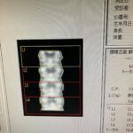 Hologic Bone Densitometer Discovery-YOM 2010 Hologic Discovery-YOM 2010 Bone Densitometer