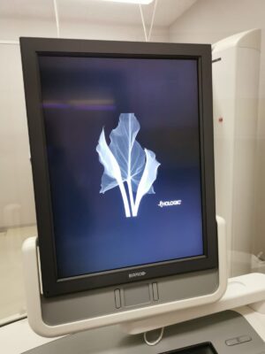 Hologic Mammo Selenia Dimensions 3D with Biopsy System-YOM 2013 Hologic Mammo Selenia Dimensions 3D with Biopsy System-YOM Mโฆ