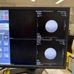 GE CT Revolution Evo GE CT Revolution Evo CT Scan