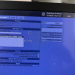 GE LOGIQ E9 Ultrasound