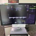 GE Vlouson E8 Ultrasound