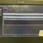 Philips Ultrasound Affiniti 30 Ultrasound