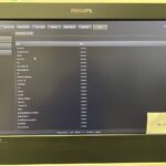 Philips Ultrasound Affiniti 30 Ultrasound