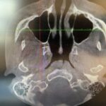 PLANMECA CBCT ProMax 3D Mid Dental Imaging