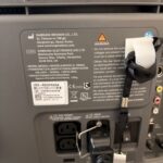 Samsung RS80A Ultrasound